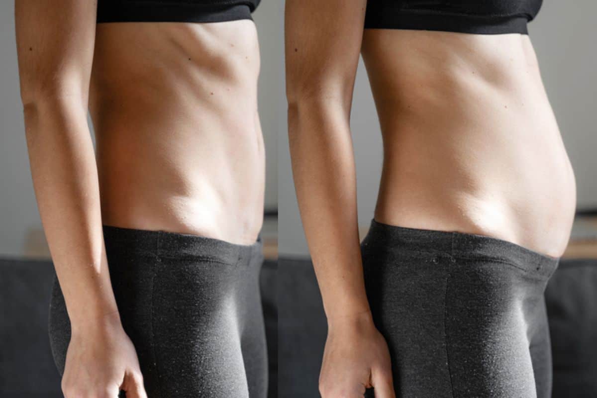 How long does diastasis recti take to improve Holland Park?
