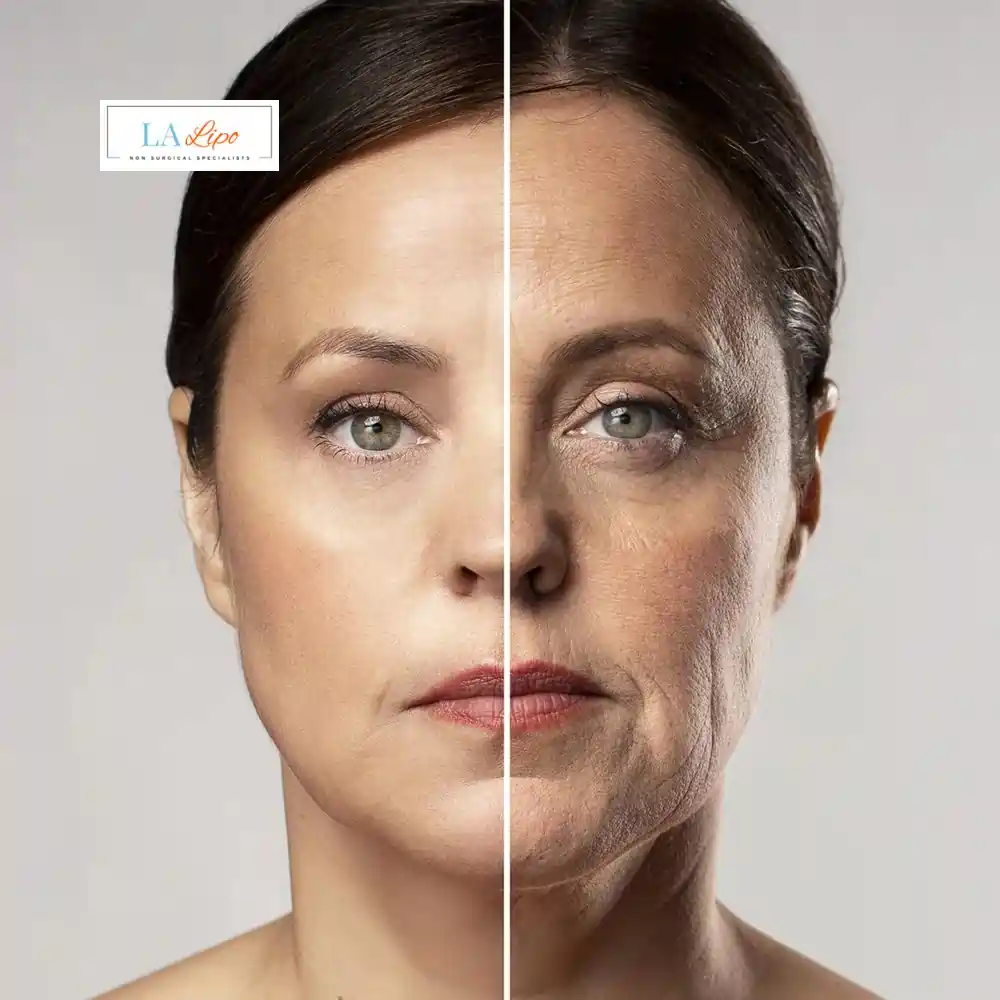 How Can You Tell If Non-Surgical Skin Tightening Is Right for You Holland Park?