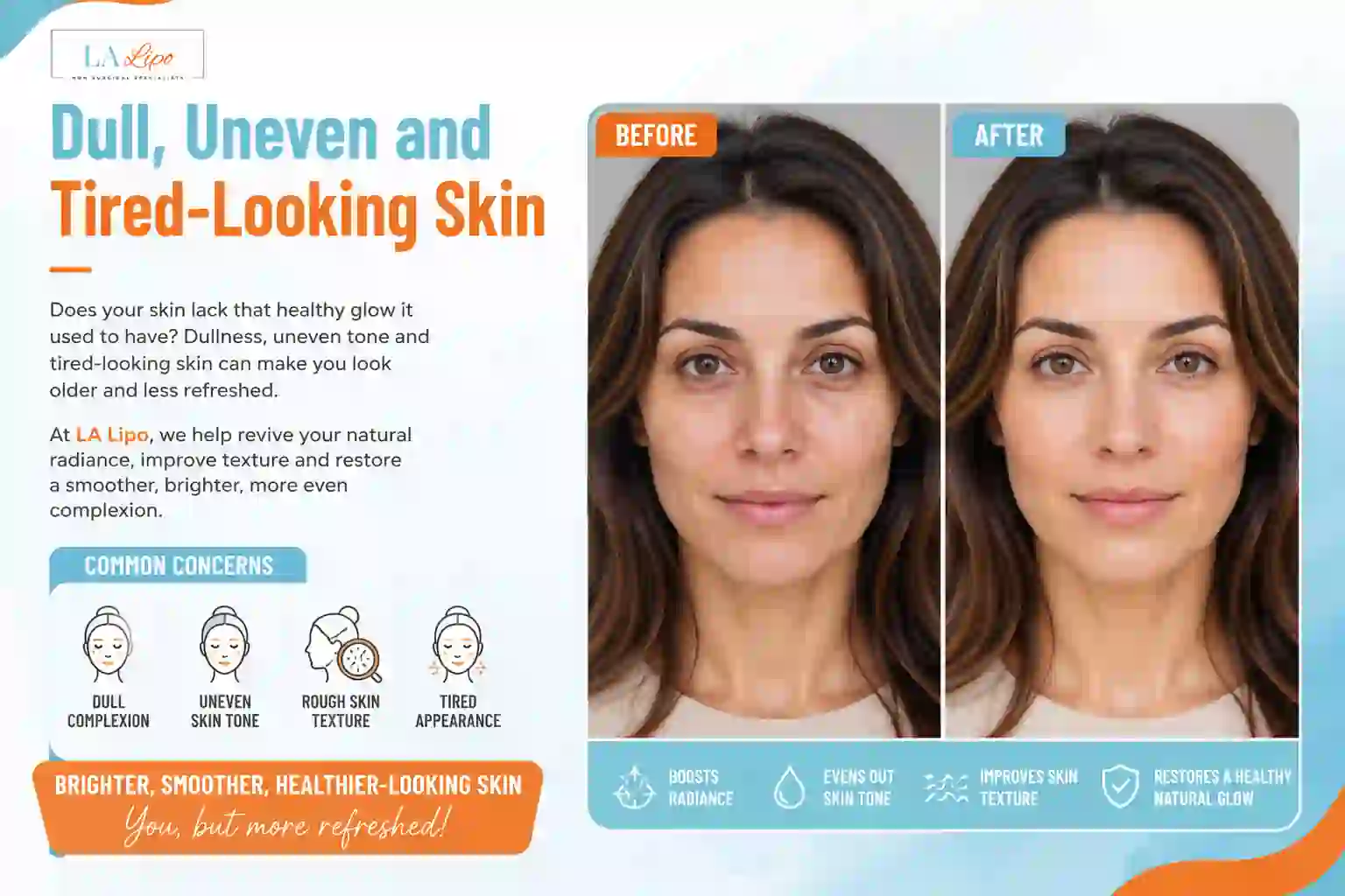 Sign #5: Dull, Uneven and Tired-Looking Skin Holland Park