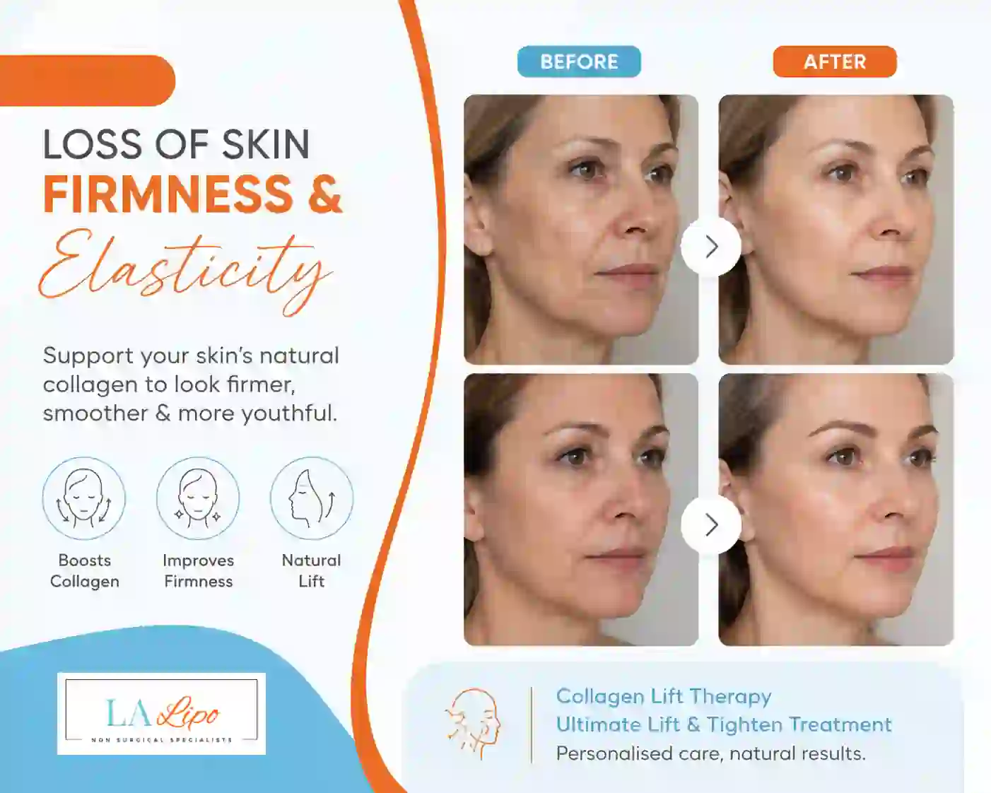 Sign #7: Loss of Skin Firmness and Elasticity Holland Park